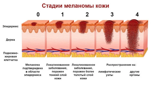orta - 9