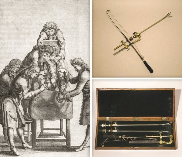 retrolito2_600x517