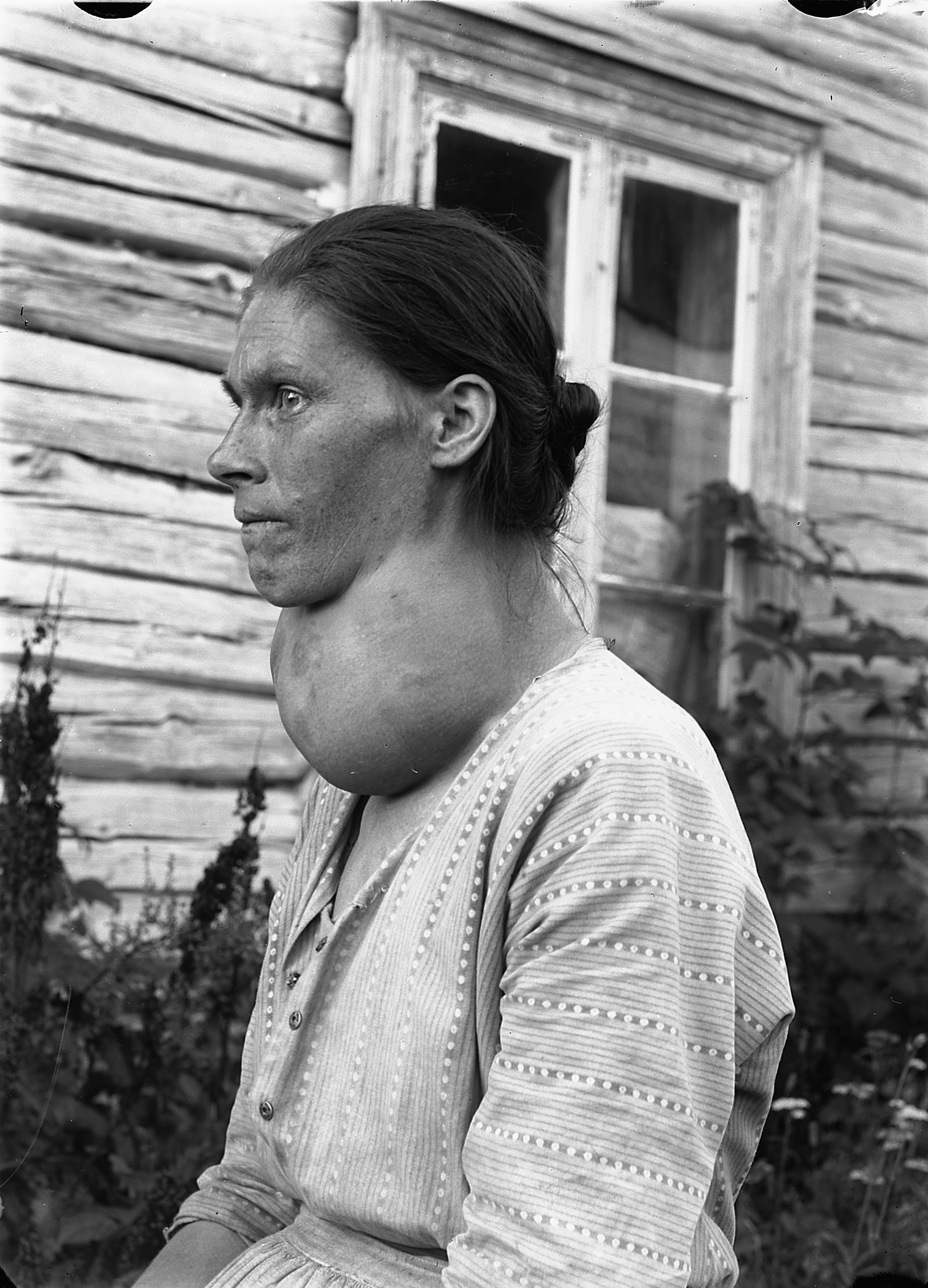 Endemik zob