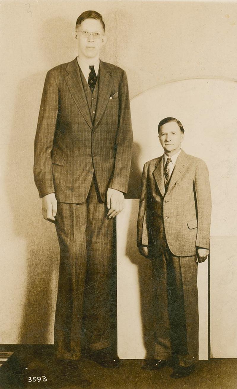 Gigantizm