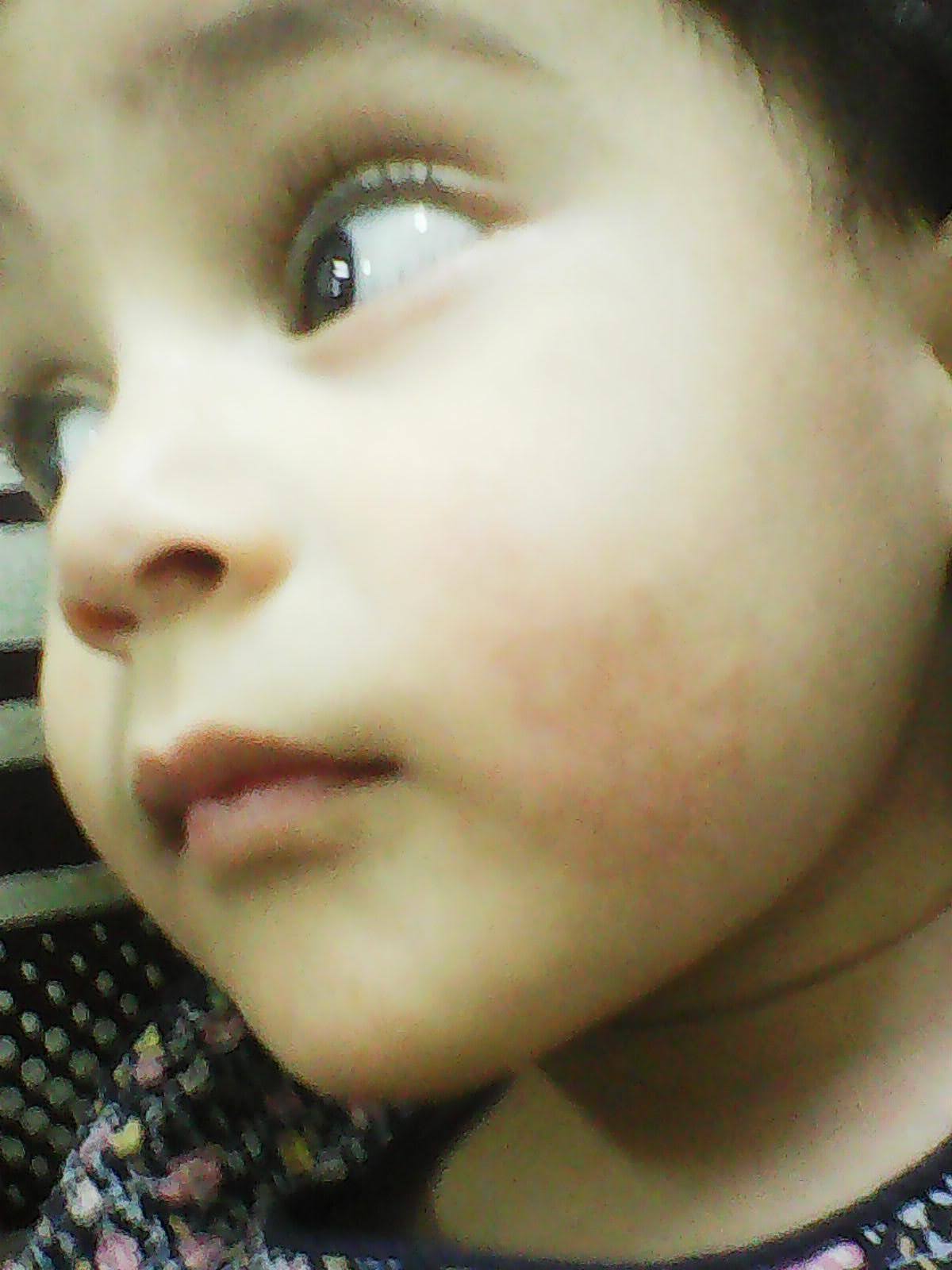 Papula