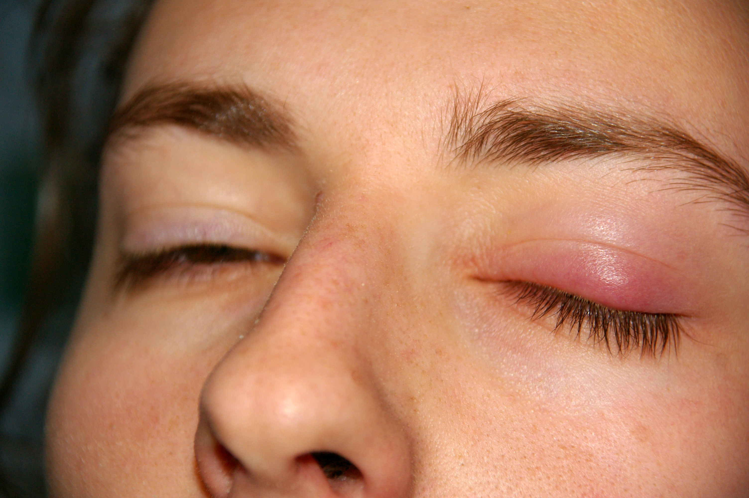 Xalyazion